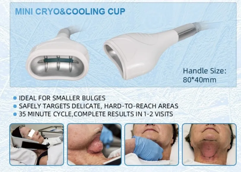 20240328212141 20240328212141