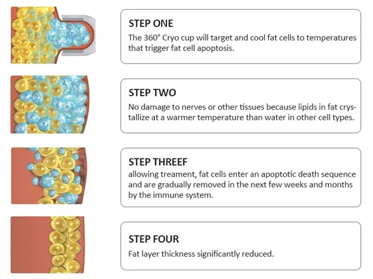 20240328203811 20240328203811